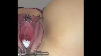 Female catheter tutorial